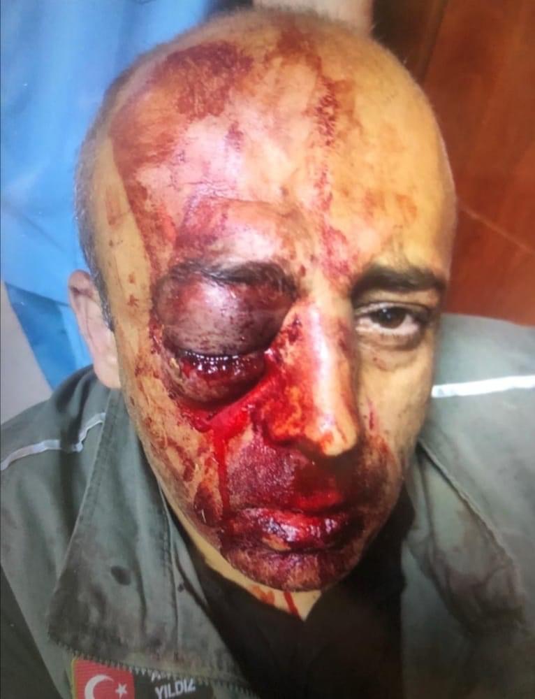 😡BU SEFER GERÇEKTEN SON OLSUN😡
